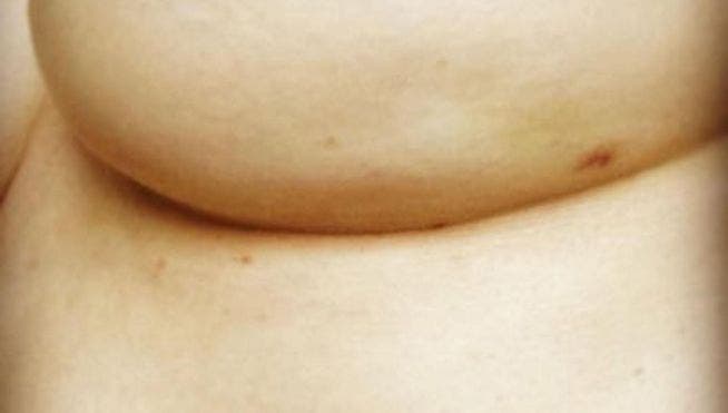SHOCK: Ella descubrió que tenía cáncer de mamas al ver una foto en Facebook - Imagen 1