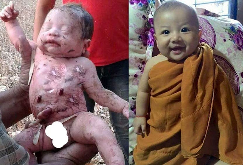 Bebé milagro sobrevivió a un brutal ataque y no creerás como se encuentra hoy - Imagen 2