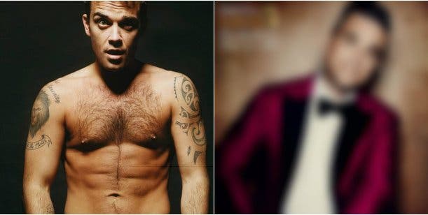 Robbie Williams está irreconocible luego de realizarse cientos de cirugías - Imagen 1
