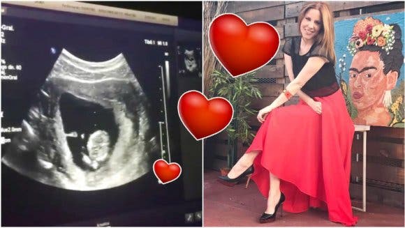Agustina Kämpfer subió a Instagram la ecografía de su bebé en camino