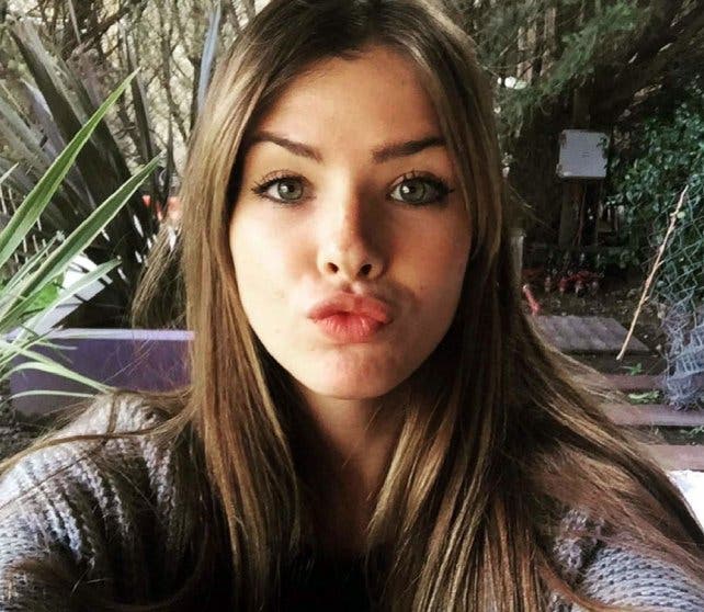 La China Suárez se puso brackets y lo mostró en Instagram La China Suárez se puso brackets y lo mostró en Instagram