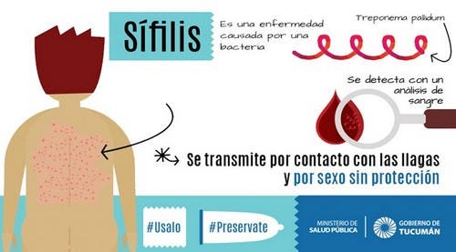 sifilis enfermedades transmision sexualidad