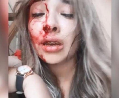 Resultado de imagen para Impactante video: una joven denunció que su novio la golpeó brutalmente cuando le dijo que quería separarse