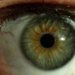 Los colores de ojos más raros en los seres humanos