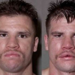 10 fotos de boxeadores antes y después de un combate