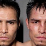 10 fotos de boxeadores antes y después de un combate