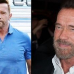 Arnold Schwarzenegger se hizo un importante retoque en la cara