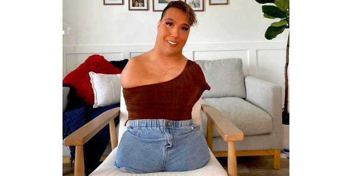 Nació Sin Brazos Ni Piernas Su Familia Lo Abandonó Y Hoy Es Furor En Tiktok Contexto Tucuman